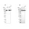 Isoleucyl-TRNA Synthetase 2, Mitochondrial antibody, NBP1-84638, Novus Biologicals, Western Blot image 