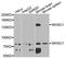 Nuclear Receptor Binding SET Domain Protein 2 antibody, A7938, ABclonal Technology, Western Blot image 