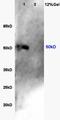 SMAD Family Member 4 antibody, orb11385, Biorbyt, Western Blot image 