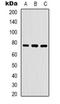 WASP Family Member 1 antibody, orb318911, Biorbyt, Western Blot image 