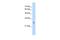 Potassium Channel Tetramerization Domain Containing 11 antibody, PA5-41088, Invitrogen Antibodies, Western Blot image 