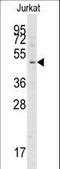 Autophagy Related 4A Cysteine Peptidase antibody, LS-C156585, Lifespan Biosciences, Western Blot image 