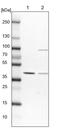 SRSF5 antibody, PA5-60383, Invitrogen Antibodies, Western Blot image 