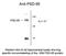 Discs Large MAGUK Scaffold Protein 4 antibody, NB300-294, Novus Biologicals, Western Blot image 