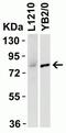 Interleukin 1 Receptor Associated Kinase 1 antibody, NBP1-77068, Novus Biologicals, Western Blot image 