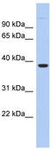 Fat Storage Inducing Transmembrane Protein 1 antibody, TA337625, Origene, Western Blot image 