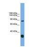 Follistatin-related protein 5 antibody, NBP1-52853, Novus Biologicals, Western Blot image 