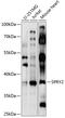 Sprouty RTK Signaling Antagonist 2 antibody, 18-348, ProSci, Western Blot image 