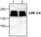 LDL Receptor Related Protein 5 antibody, GTX59655, GeneTex, Western Blot image 