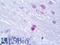 Oligodendrocyte Transcription Factor 1 antibody, LS-B12170, Lifespan Biosciences, Immunohistochemistry paraffin image 