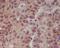 p16-INK4 antibody, M00016, Boster Biological Technology, Immunohistochemistry frozen image 