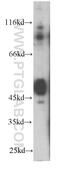 TNF Receptor Superfamily Member 1A antibody, 60192-1-Ig, Proteintech Group, Western Blot image 