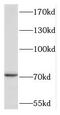 Transforming Acidic Coiled-Coil Containing Protein 2 antibody, FNab08468, FineTest, Western Blot image 