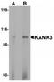 KN Motif And Ankyrin Repeat Domains 3 antibody, TA320153, Origene, Western Blot image 