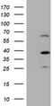 Dystrobrevin Beta antibody, LS-C173761, Lifespan Biosciences, Western Blot image 