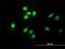 Testis Associated Actin Remodelling Kinase 2 antibody, H00010420-M01, Novus Biologicals, Immunofluorescence image 