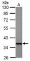 DnaJ Heat Shock Protein Family (Hsp40) Member B5 antibody, NBP2-16192, Novus Biologicals, Western Blot image 