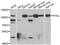 Glycogen Phosphorylase L antibody, STJ28793, St John