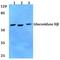 Protein Kinase C Substrate 80K-H antibody, A04992-1, Boster Biological Technology, Western Blot image 