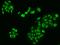 LUC7 Like 2, Pre-MRNA Splicing Factor antibody, 205888-T02, Sino Biological, Immunohistochemistry paraffin image 