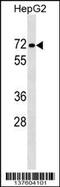 Protein Phosphatase 1 Regulatory Subunit 16B antibody, 59-308, ProSci, Western Blot image 