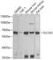 Solute Carrier Family 2 Member 2 antibody, 23-939, ProSci, Western Blot image 