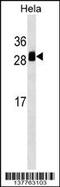 Transmembrane P24 Trafficking Protein 1 antibody, 59-399, ProSci, Western Blot image 