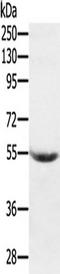 Serpin Family G Member 1 antibody, TA351657, Origene, Western Blot image 