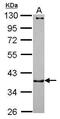 Catenin Alpha 3 antibody, PA5-30535, Invitrogen Antibodies, Western Blot image 