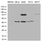 Pentatricopeptide Repeat Domain 3 antibody, M10795, Boster Biological Technology, Western Blot image 