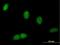 Bromodomain And WD Repeat Domain Containing 1 antibody, H00054014-B01P, Novus Biologicals, Immunocytochemistry image 