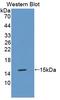 Metallothionein 3 antibody, LS-C295361, Lifespan Biosciences, Western Blot image 