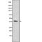 Purinergic Receptor P2Y12 antibody, abx217587, Abbexa, Western Blot image 