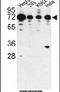 Phosphatase And Actin Regulator 2 antibody, PA5-14597, Invitrogen Antibodies, Western Blot image 