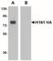 Seasonal H1N1 Hemagglutinin antibody, NBP2-41328, Novus Biologicals, Western Blot image 