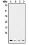 Ubiquitin A-52 Residue Ribosomal Protein Fusion Product 1 antibody, orb214708, Biorbyt, Western Blot image 