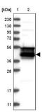 WD Repeat Domain 31 antibody, NBP1-81962, Novus Biologicals, Western Blot image 