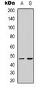 LUC7 Like 2, Pre-MRNA Splicing Factor antibody, LS-C368918, Lifespan Biosciences, Western Blot image 
