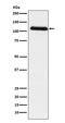 Fibrinogen Alpha Chain antibody, M00816-1, Boster Biological Technology, Western Blot image 