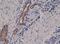 Melanoma Cell Adhesion Molecule antibody, NBP2-61563, Novus Biologicals, Immunohistochemistry paraffin image 