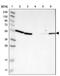 Kelch Domain Containing 1 antibody, NBP1-82616, Novus Biologicals, Western Blot image 