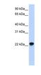 ADP Ribosylation Factor Like GTPase 8A antibody, NBP1-58860, Novus Biologicals, Western Blot image 