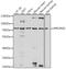 Protein Phosphatase 2 Regulatory Subunit B'Delta antibody, 16-191, ProSci, Western Blot image 