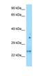 Oligodendrocyte Transcription Factor 1 antibody, orb330457, Biorbyt, Western Blot image 