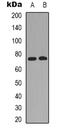 Raf-1 Proto-Oncogene, Serine/Threonine Kinase antibody, LS-B14835, Lifespan Biosciences, Western Blot image 