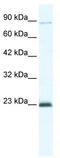 Minichromosome Maintenance Complex Component 4 antibody, TA341694, Origene, Western Blot image 