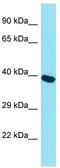 Minichromosome Maintenance Complex Component 7 antibody, TA341706, Origene, Western Blot image 