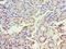 Abhydrolase Domain Containing 5 antibody, orb352745, Biorbyt, Immunohistochemistry paraffin image 