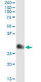 TIMP Metallopeptidase Inhibitor 1 antibody, LS-C198343, Lifespan Biosciences, Immunoprecipitation image 