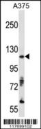 AXL Receptor Tyrosine Kinase antibody, 63-031, ProSci, Western Blot image 